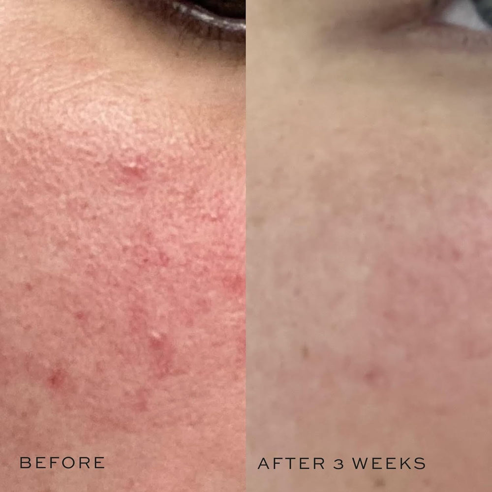DIME Super Skin Toner features aloe vera and cucumber for soothing cooling sensation