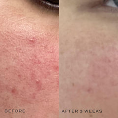 DIME Super Skin Toner features aloe vera and cucumber for soothing cooling sensation