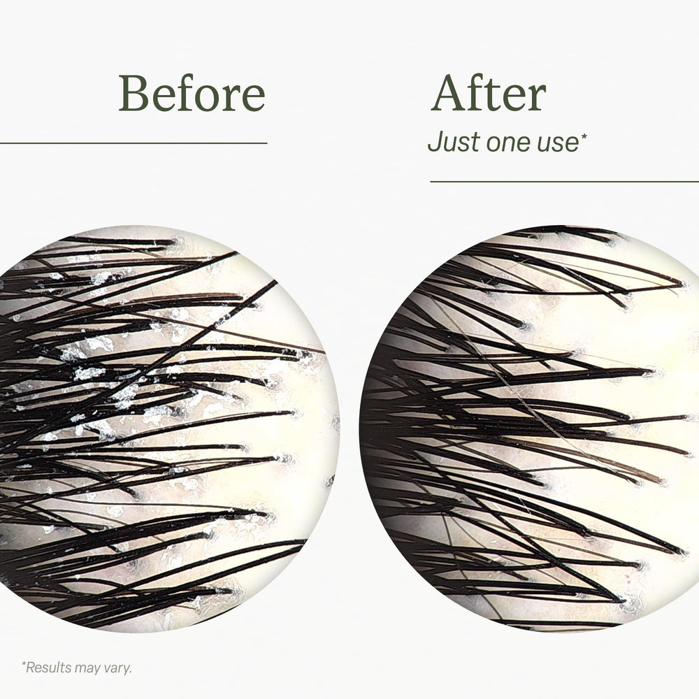 Divi oil-control formula close-up illustrating targeted oil balance for scalp