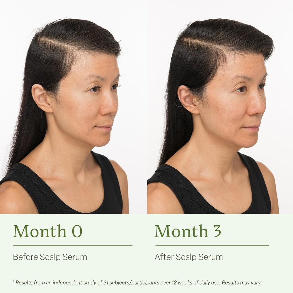 Divi Scalp Serum rosemary oil bottle emphasizing natural active ingredients.