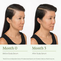 Divi Scalp Serum rosemary oil bottle emphasizing natural active ingredients.