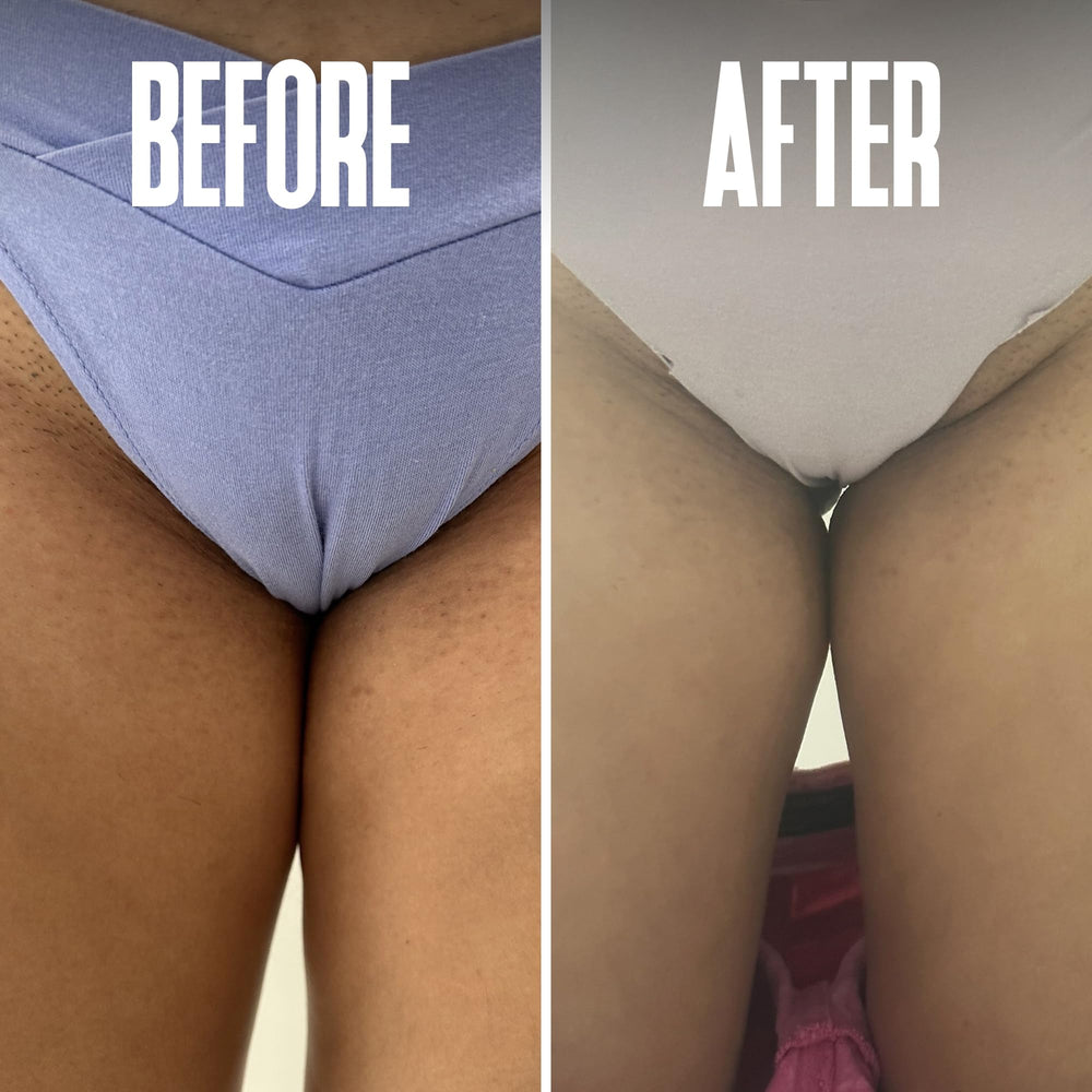 Divine Derriere underarm or leg use showing smooth skin results