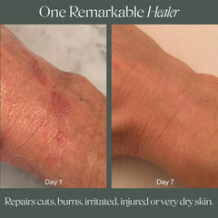 Hands-and-feet care with Doctor Rogers Restore Healing Balm delivers hydration.