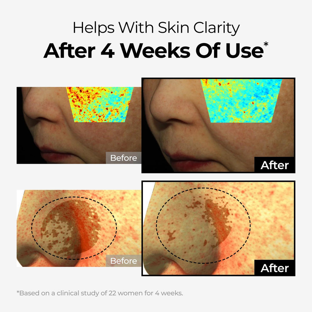 Hands warming the cream to improve skin absorption and comfort
