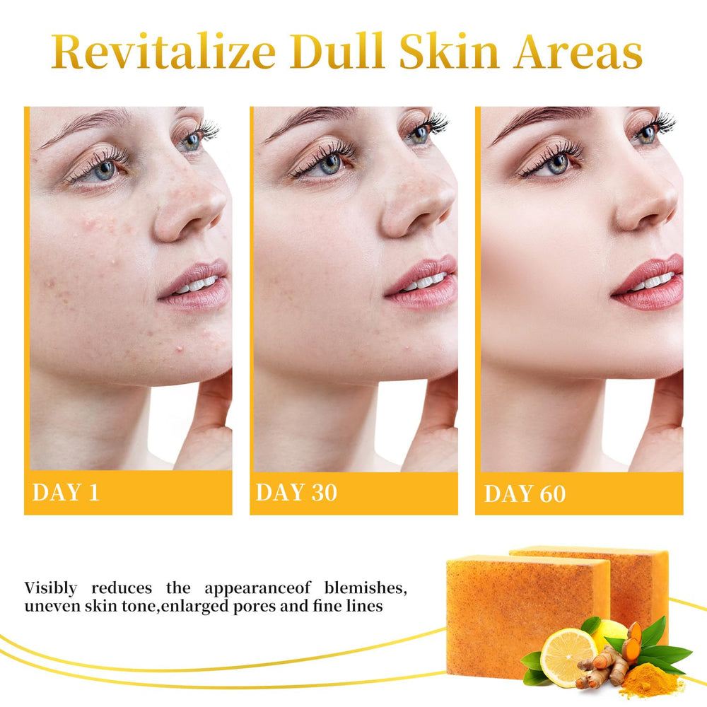 DOXOLATO lemon turmeric soap bar body: full-body cleanse with exfoliation.