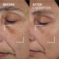 Dr. Brandt Bright This Way C Scription serum applied to the face for quick absorption.