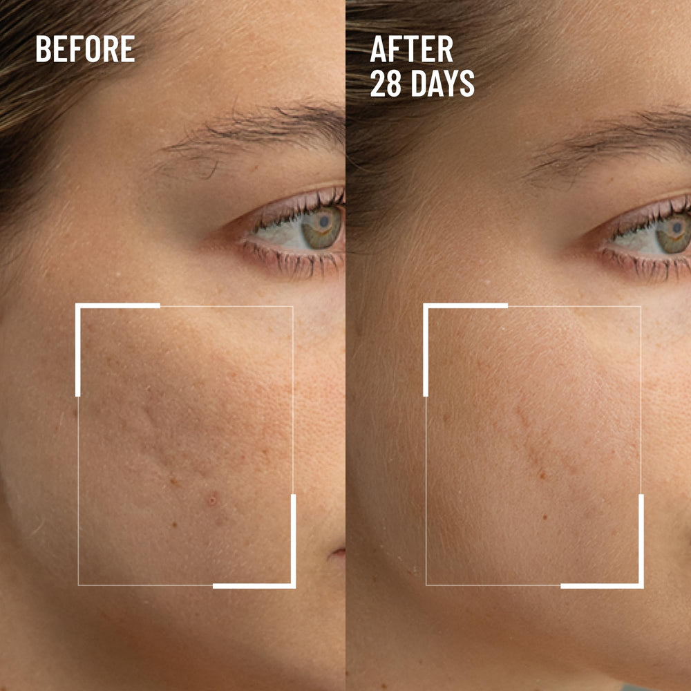 Dr. Brandt Renewing Face Exfoliator bottle close-up signals premium, spa-grade at-home treatment.