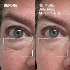 Dr. Brandt Needles No More Baggage close-up texture shows rapid absorption.
