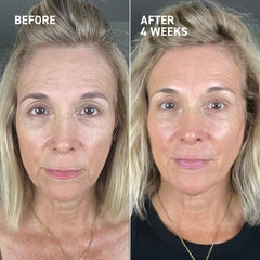 Dr. Brandt Needles No More application scene for nightly skin ritual