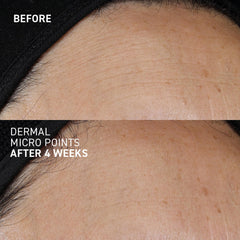 Dr. Brandt Needles No More pairs with Hyaluronic Face Cream for hydration