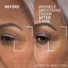 Dr. Brandt Needles No More Wrinkle Smoothing Cream bottle pump shows convenient dosing for targeted use.