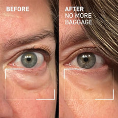 Dr. Brandt Needles No More two-pack packaging supports consistent use.