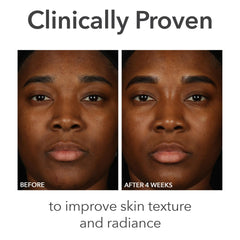 Dr Dennis Gross Alpha Beta Balance texture close-up reveals smooth, balanced skin potential after use.