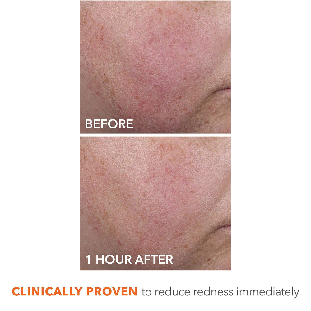 Cream swirl on skin demonstrates plumping and smoothing effects.