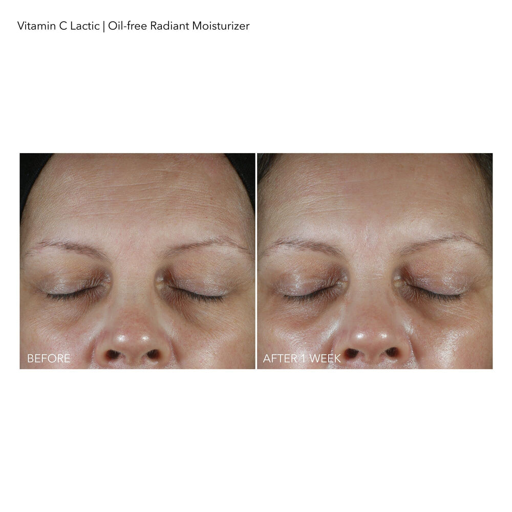 Dr Dennis Gross VitC+Lactic close-up on clean face