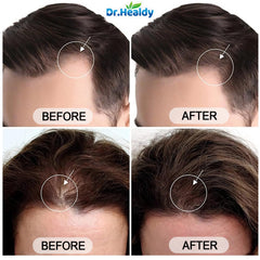 Dr. Healdy Batana Oil Shampoo scalp massage scene suggests a soothing wellness routine