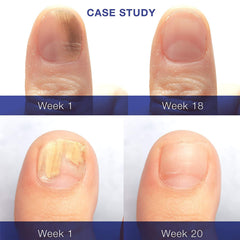 Dr. Luke Nail Repair Liquid brush applies a thin layer on nails.