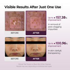 Dr.Melaxin Mochi whip texture close-up highlighting creamy lather for balanced skin.