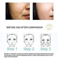 DR.RASHEL serum applied on the face
