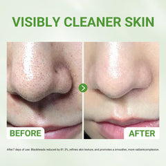Dr.Leo mask performs deep pore cleansing by drawing out impurities for refreshed skin.