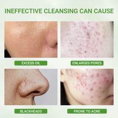 Dr.Leo 3X Acid Mask application on face demonstrates exfoliation and pore refinement.