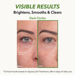 Dr. MEDION Spaoxy CO2 bubbling action illustrates at-home treatment concept.