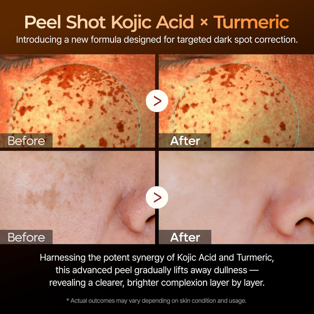 Dr.Melaxin Peel Shot serum dropper close-up for precise dosing