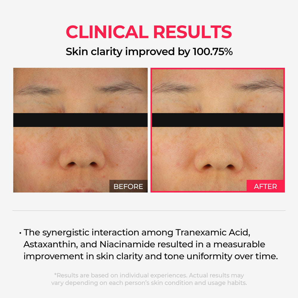 Dr.Melaxin TXA mask application close-up demonstrates overnight layering for glow.