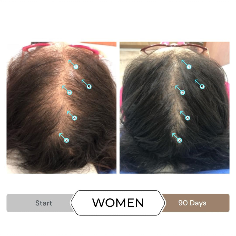 DS Laboratories Spectral Booster application tip for targeted thinning areas
