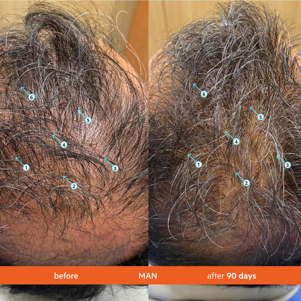 Revita shampoo application shot emphasizing root-to-tip cleansing.