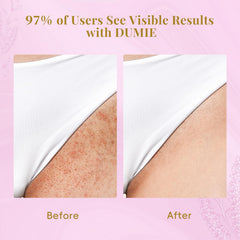 Dumie non-greasy formula absorbs quickly after application