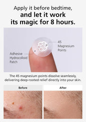 DWEasyDerm pharmaceutical-quality patch from Daewoong for reliable acne care