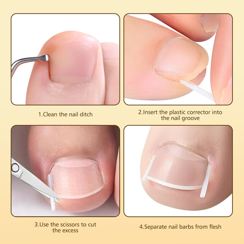 Dynaxor ingrown nail lifter tool for clean edge lifting