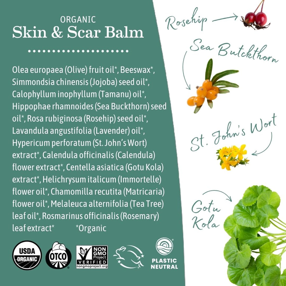 Earth Mama Organic Calendula bloom image suggests gentle support for sensitive skin.