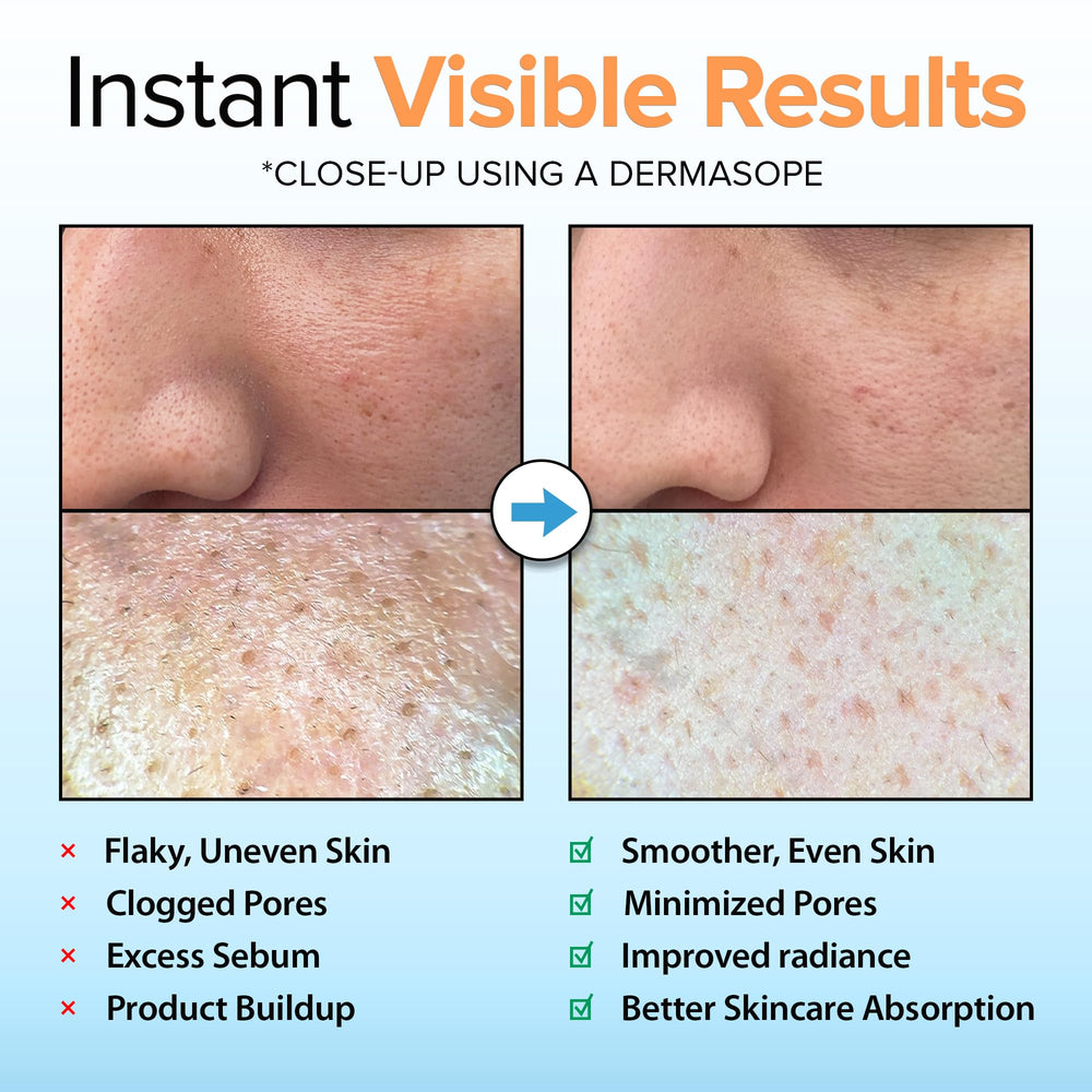 Vitamin C and hydration components visible in Ebanel peeling gel for brightening effect.