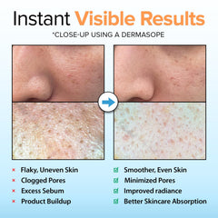 Vitamin C and hydration components visible in Ebanel peeling gel for brightening effect.