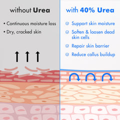Ebanel Urea Cream 40% heel-crack-treatment for smoother skin