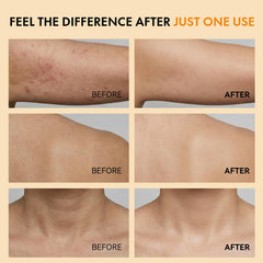 Close-up of improved skin texture using Kojic and Turmeric blend.