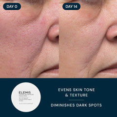 Texture close-up of the Dynamic Resurfacing Pads by ELEMIS