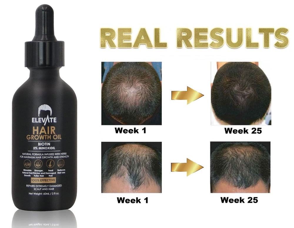 Elevate Packaging 2oz Bottle; value size for extended treatment.