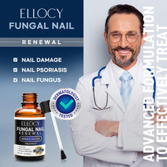 Daily use steps soak, file, and apply Ellocy liquid.