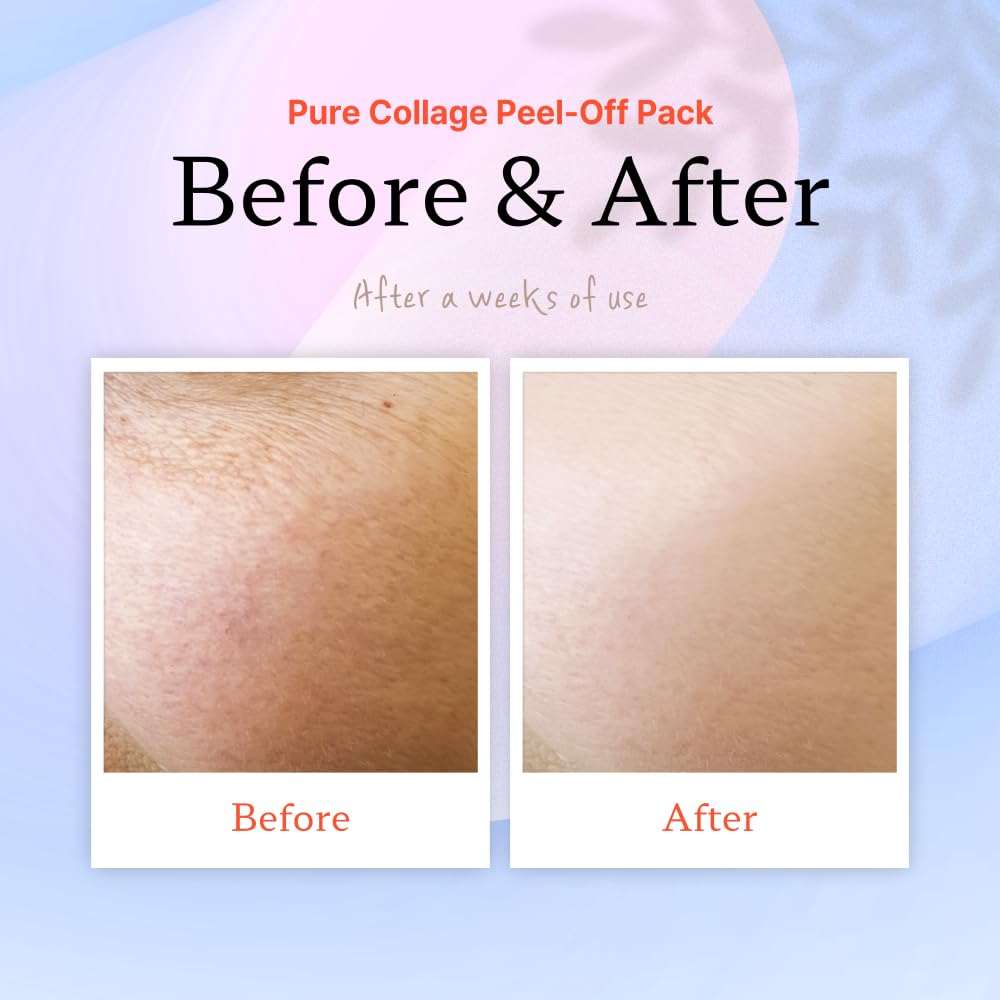 ELT five-types collagen formula supports skin structure and resilience.