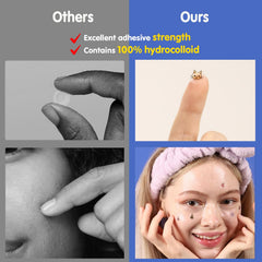 EMO PATCH hydrocolloid technology absorbs fluids around blemishes