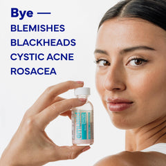 Sulfur-rich EMUAID formula highlighted for acne-prone skin support