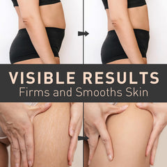 Enaskin Naturals Belly Firming Cream absorbs quickly for hydrated skin.