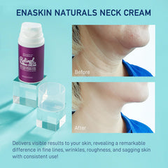 Packaging of Enaskin Naturals neck cream highlights premium ingredients for nourishment.