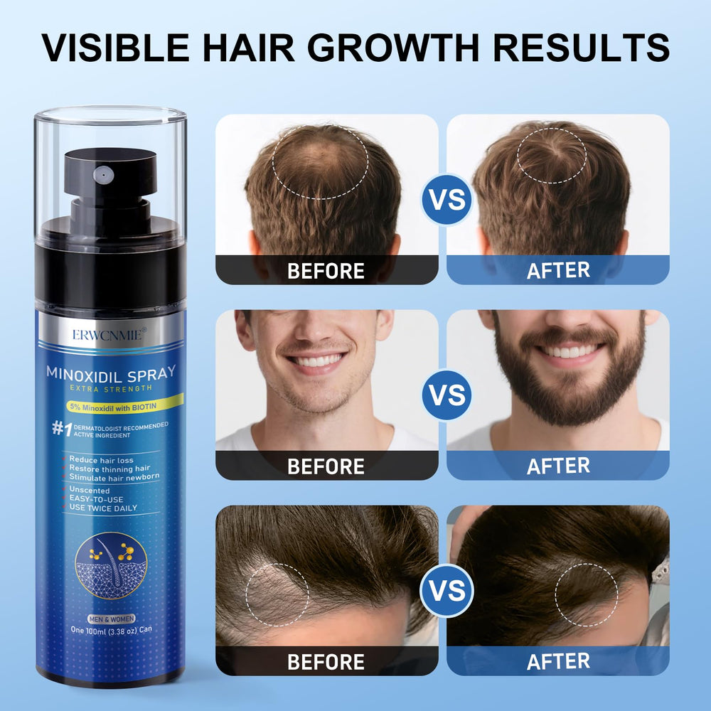 ERWCNMIE minoxidil bottle label highlighting key ingredients