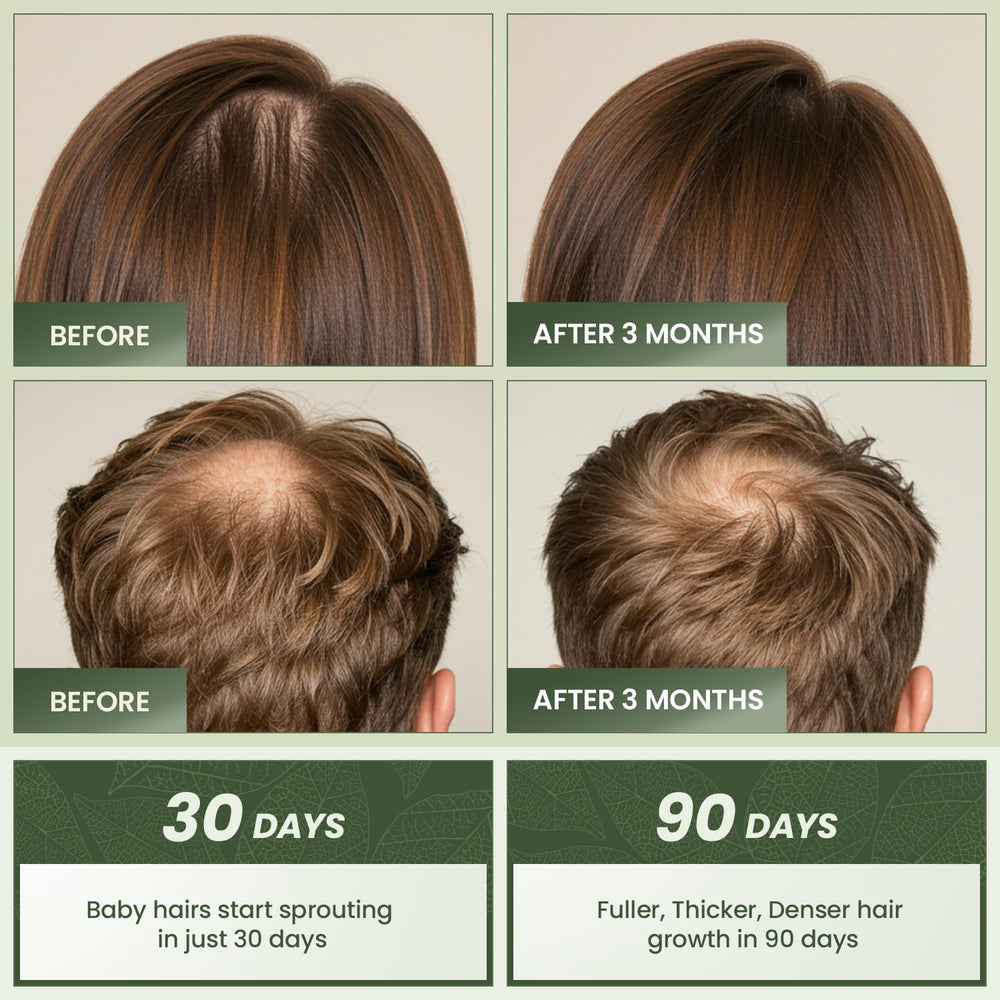EssyNaturals Advanced Hair Growth Oil ingredient castor oil highlights nourishing formula.