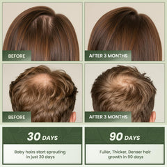 EssyNaturals Advanced Hair Growth Oil ingredient castor oil highlights nourishing formula.