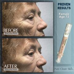 EUZEN Applying cream to cheeks for a refreshed look.